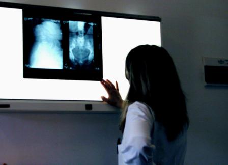 Doutora examinando unhas radiografías