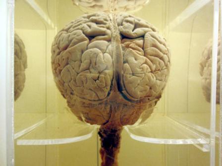 imaxe do cortiza frontal dun cerebro