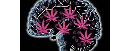 Radiografía dun cerebro con marihuana